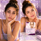 Parche antiarrugas SP-3 resultado en piel — UNIIK4U